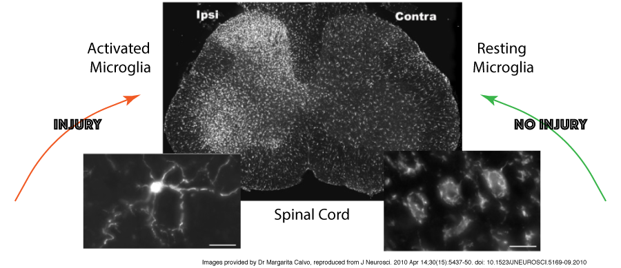 Research Studies Explained 3 – brain image activated and resting microglia